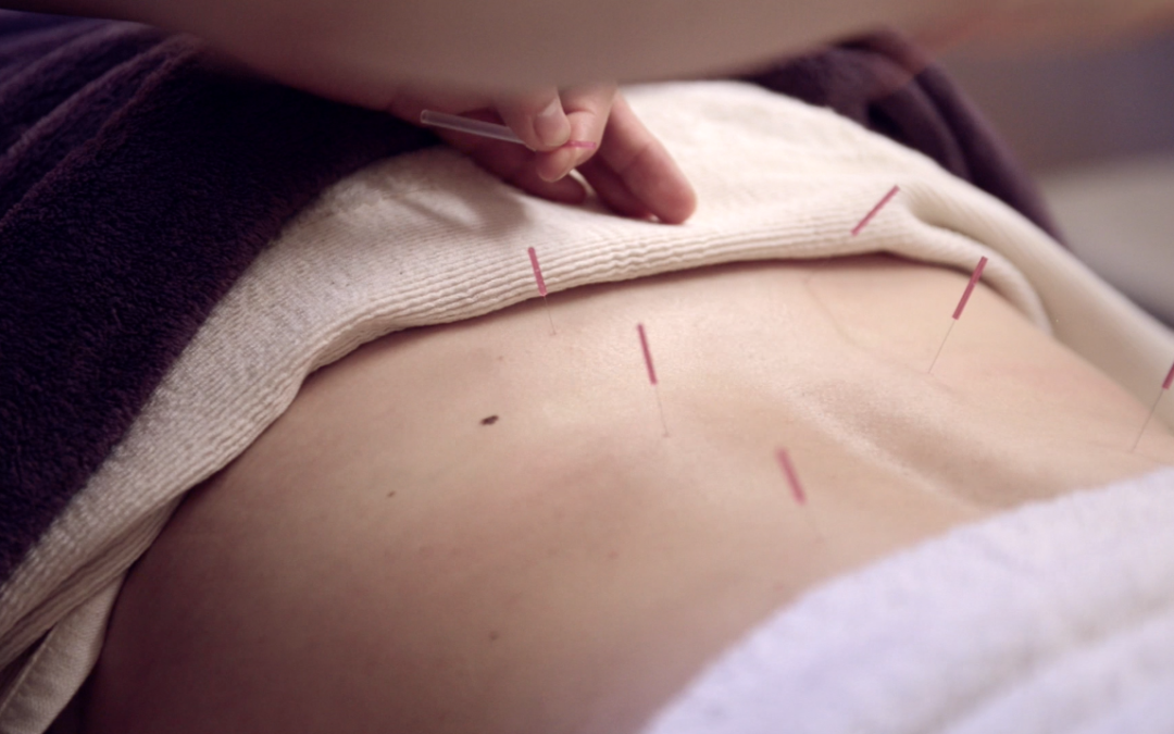 Spotlight on: Japanese Acupuncture